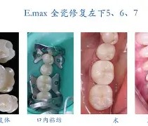 爱游戏体育注册-剠?5{+Z&amp;磟;=^寽跾#y?o\(弜嵌洶鯫e鰱龅