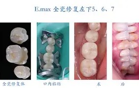 爱游戏体育注册-剠?5{+Z&amp;磟;=^寽跾#y?o\(弜嵌洶鯫e鰱龅